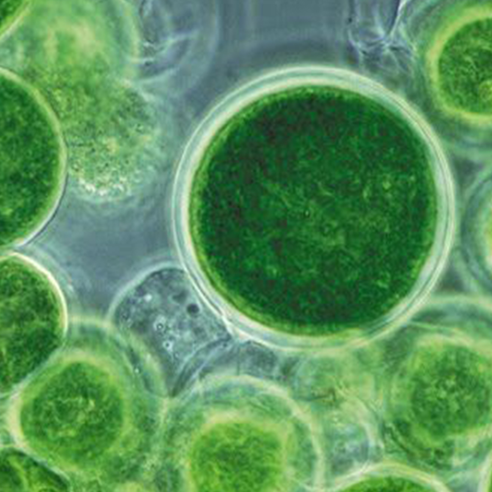 Algues Vertes - L'étincelle